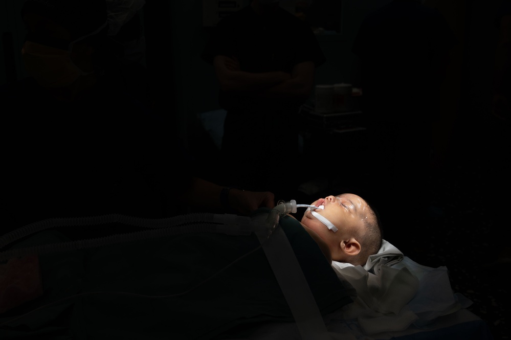 Cleft Lip Surgery Aboard USNS Comfort CP25