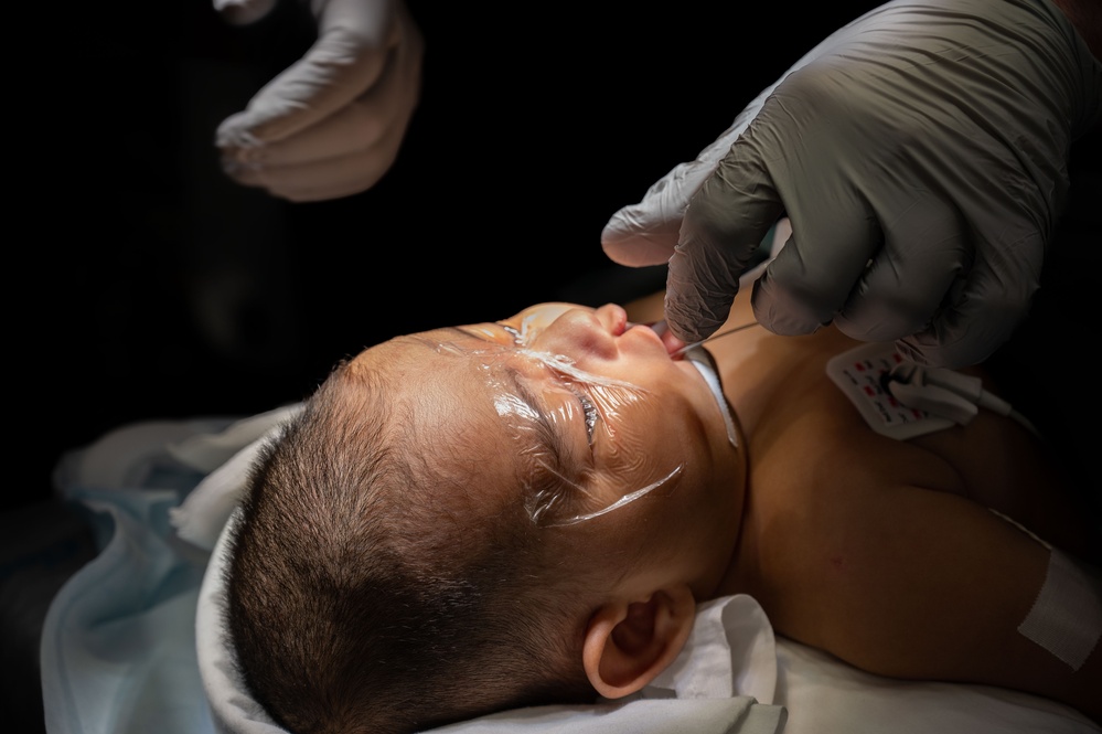 Cleft Lip Surgery Aboard USNS Comfort CP25
