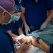 Cleft Lip Surgery Aboard USNS Comfort CP25