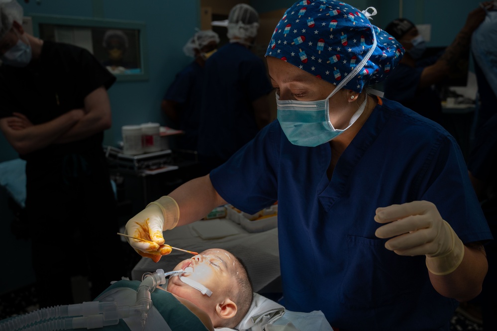 Cleft Lip Surgery Aboard USNS Comfort CP25