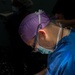 Cleft Lip Surgery Aboard USNS Comfort CP25