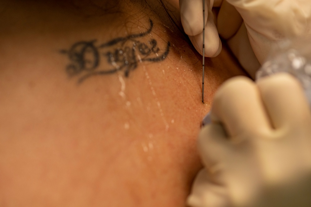 CP25 Surgeons Perform Pre-Operation Injections