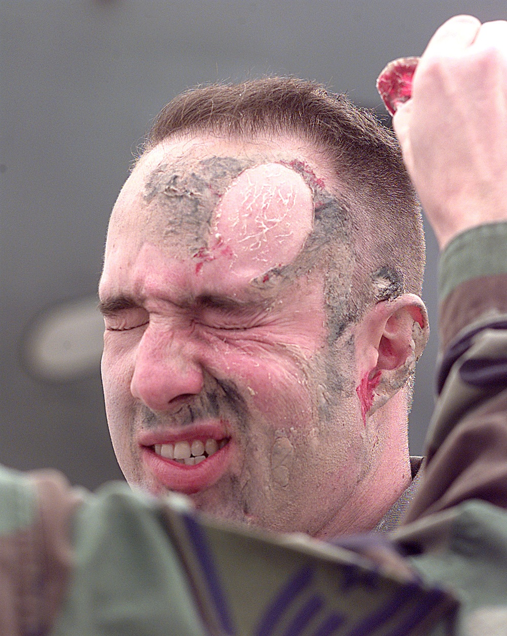 Staff Sgt. Gary Cleland winces in pain as mulage, simulating head injuries, is removed.