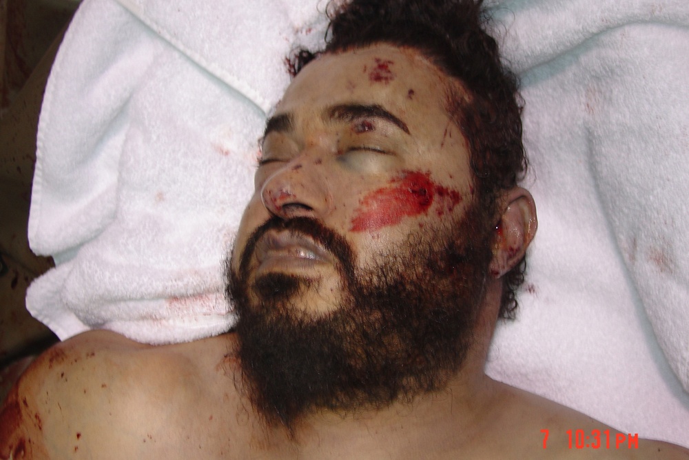 The body of Abu Musab al-Zarqawi photographed after he was killed.