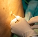 CP25 Hospital Surgery SMEE Costa Rica