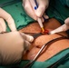 CP25 Hospital Surgery SMEE Costa Rica