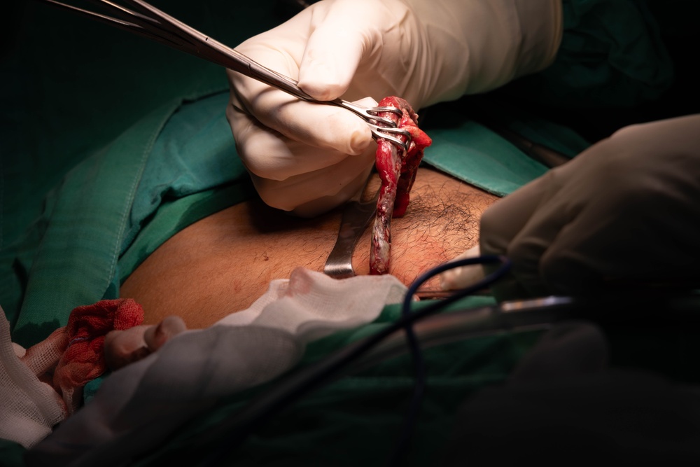 CP25 Hospital Surgery SMEE Costa Rica