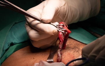 CP25 Hospital Surgery SMEE Costa Rica