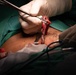 CP25 Hospital Surgery SMEE Costa Rica