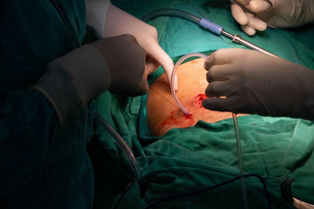 CP25 Hospital Surgery SMEE Costa Rica