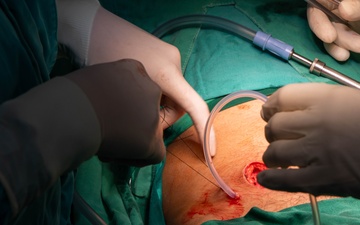 CP25 Hospital Surgery SMEE Costa Rica