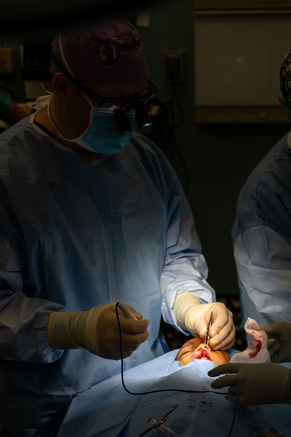 CP25 Cleft Lip Surgery in Trinidad and Tobago
