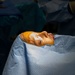 CP25 Cleft Lip Surgery in Trinidad and Tobago