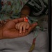 CP25 Cleft Lip Surgery in Trinidad and Tobago