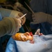 CP25 Cleft Lip Surgery in Trinidad and Tobago