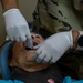 U.S., Paraguayan dental teams perform first endodontic procedures during AMISTAD 2025