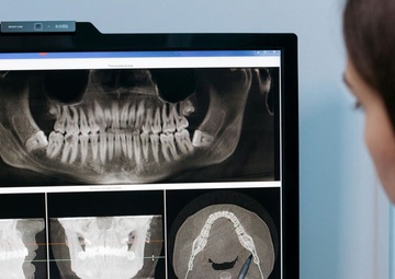 TRICARE Medical vs. Dental Coverage: Understanding Key Differences