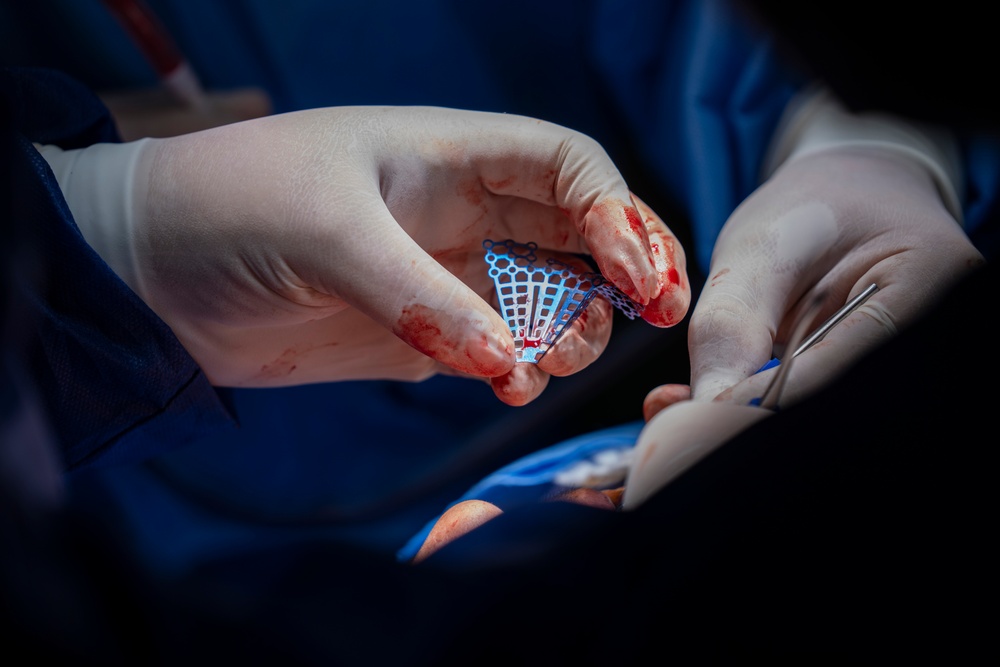 Paraguayan, U.S. surgeons restore sight, rebuild face during AMISTAD 2025