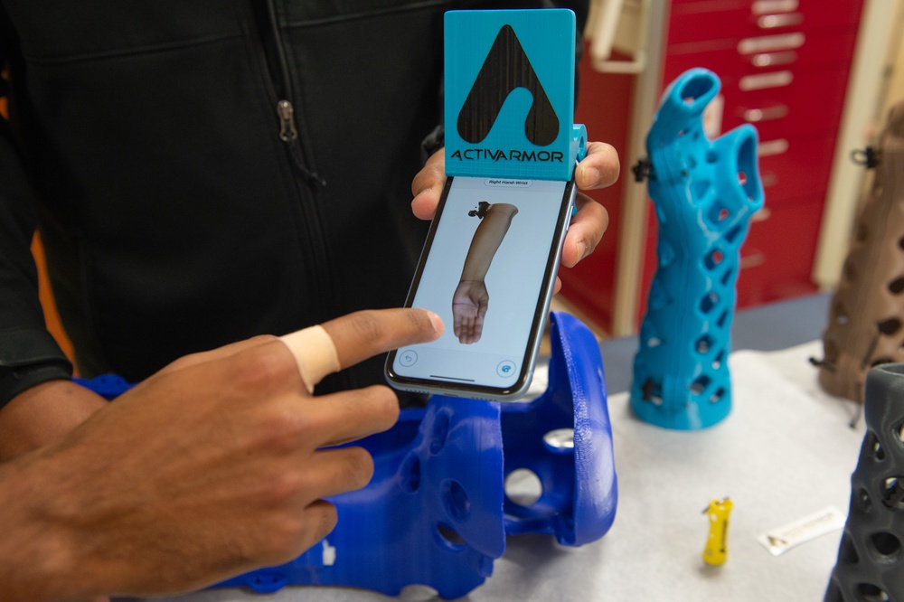 NMCSD enhances orthopedic care with 3D-printed waterproof casts