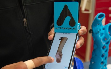 NMCSD enhances orthopedic care with 3D-printed waterproof casts