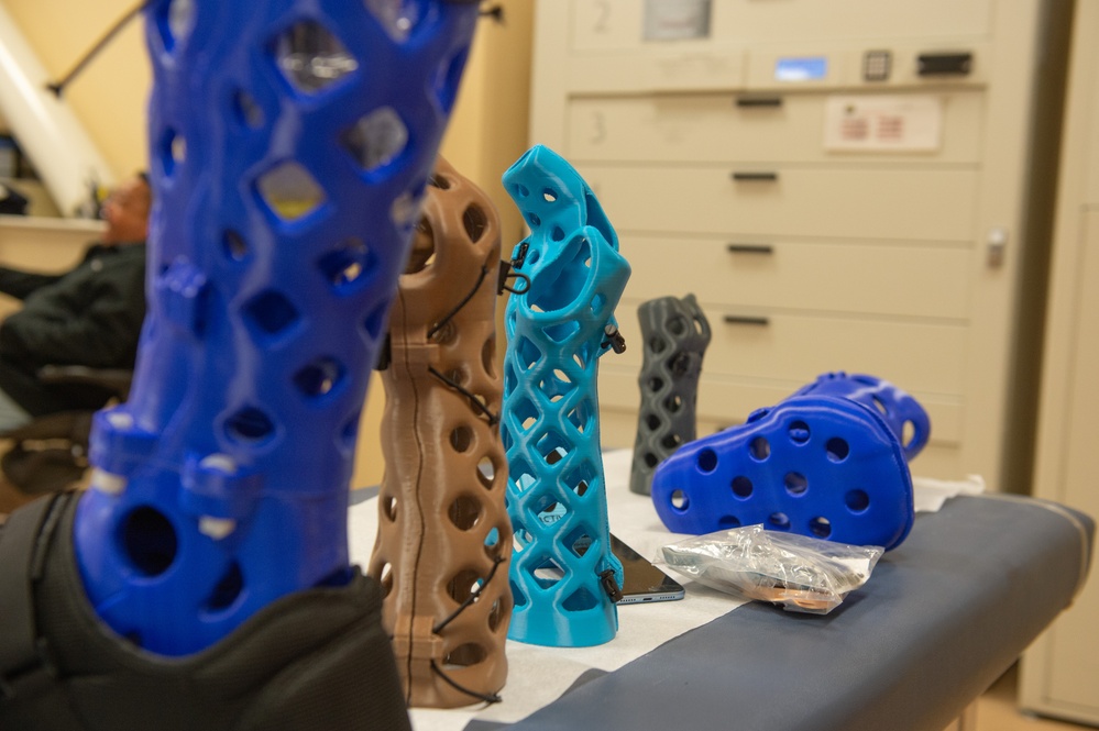 NMCSD enhances orthopedic care with 3D-printed waterproof casts