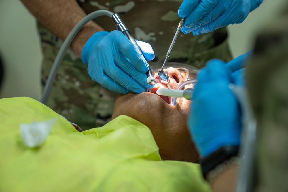 AMISTAD 2025 Dental Teams Ease Backlog in La Mesa