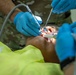 AMISTAD 2025 Dental Teams Ease Backlog in La Mesa