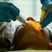 AMISTAD 2025 Dental Teams Ease Backlog in La Mesa