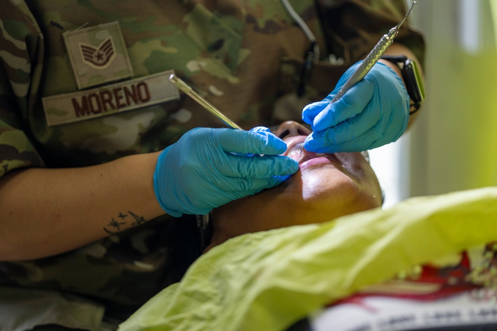 AMISTAD 2025 Dental Teams Ease Backlog in La Mesa