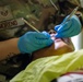 AMISTAD 2025 Dental Teams Ease Backlog in La Mesa