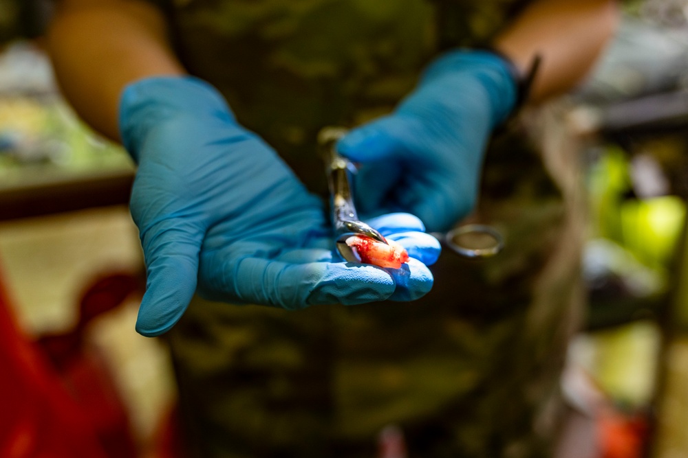 AMISTAD 2025 Dental Teams Ease Backlog in La Mesa