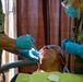 AMISTAD 2025 Dental Teams Ease Backlog in La Mesa