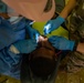 AMISTAD 2025 Dental Teams Ease Backlog in La Mesa