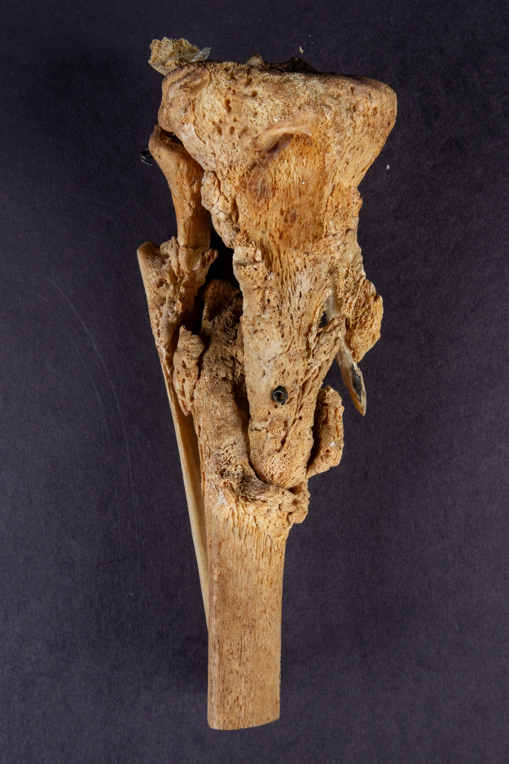 Right Tibia and Fibula of Union Army Pvt. Henry Haycook