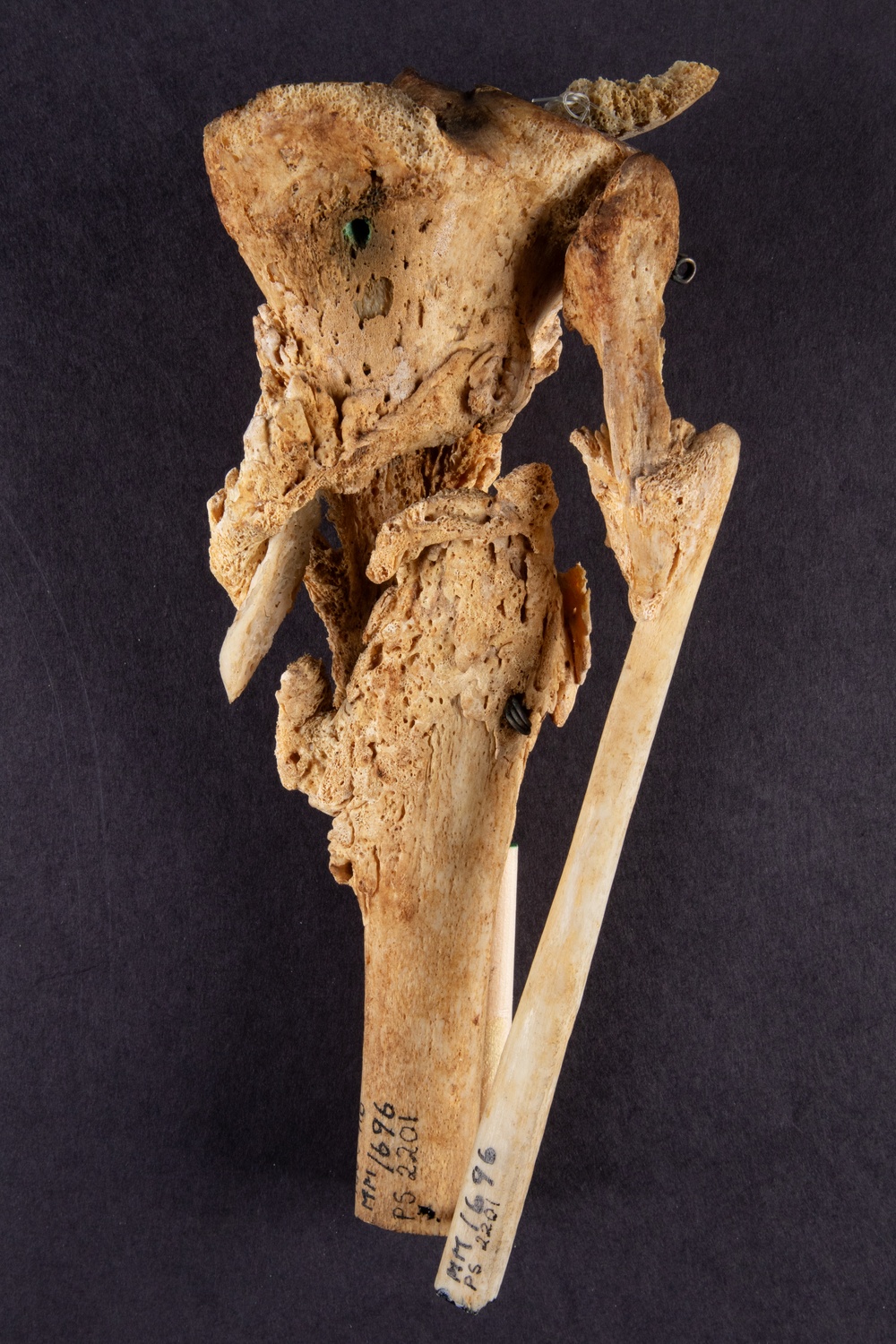 Right Tibia and Fibula of Union Army Pvt. Henry Haycook