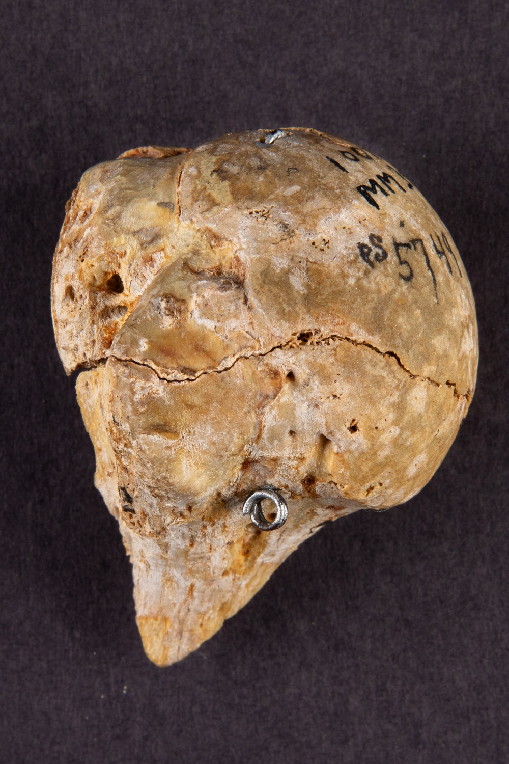 Head of the Right Humerus of Union Army Pvt. Michael Punch