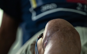 Meaning beyond movement: JTF-Bravo physical therapist provides hope to Honduran communities