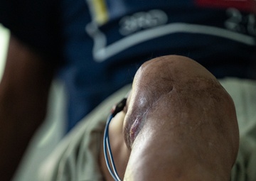 Meaning beyond movement: JTF-Bravo physical therapist provides hope to Honduran communities