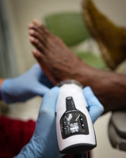 Shockwave Therapy for Foot Injury