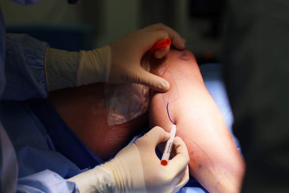 Maxillofacial Program at NMCSD Restores Form, Function, and Readiness