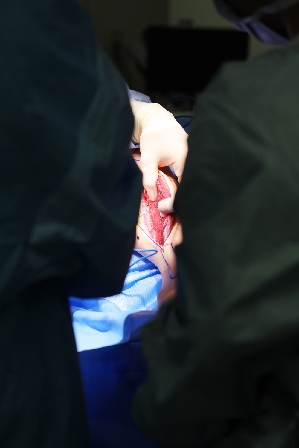 Maxillofacial Program at NMCSD Restores Form, Function, and Readiness