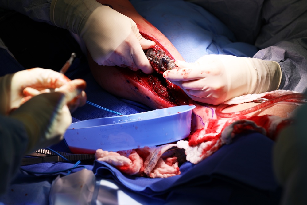 Maxillofacial Program at NMCSD Restores Form, Function, and Readiness