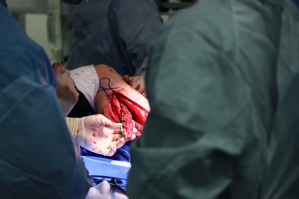 Maxillofacial Program at NMCSD Restores Form, Function, and Readiness