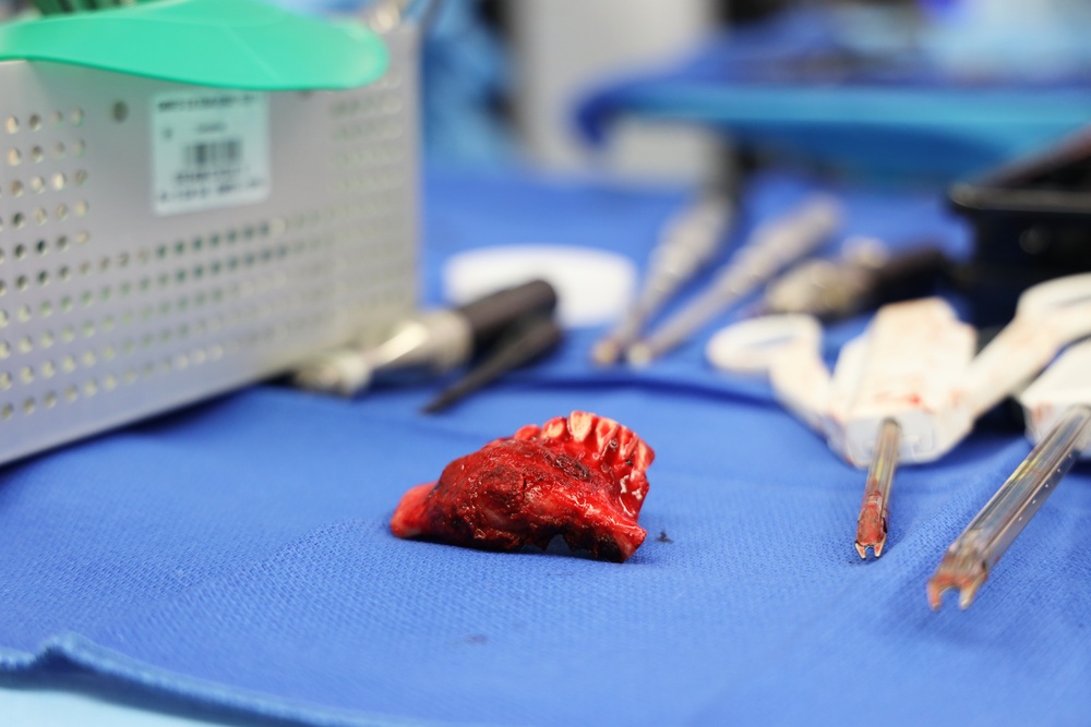 Maxillofacial Program at NMCSD Restores Form, Function, and Readiness