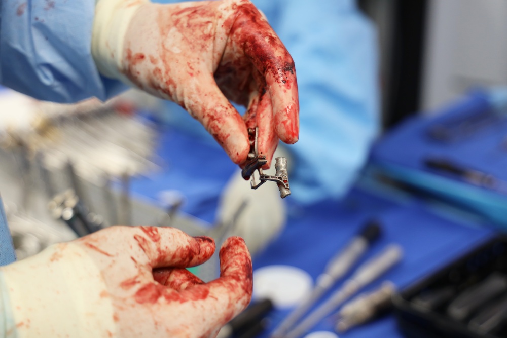 Maxillofacial Program at NMCSD Restores Form, Function, and Readiness