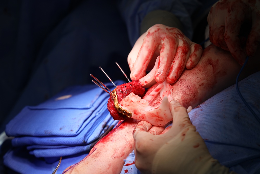 Maxillofacial Program at NMCSD Restores Form, Function, and Readiness