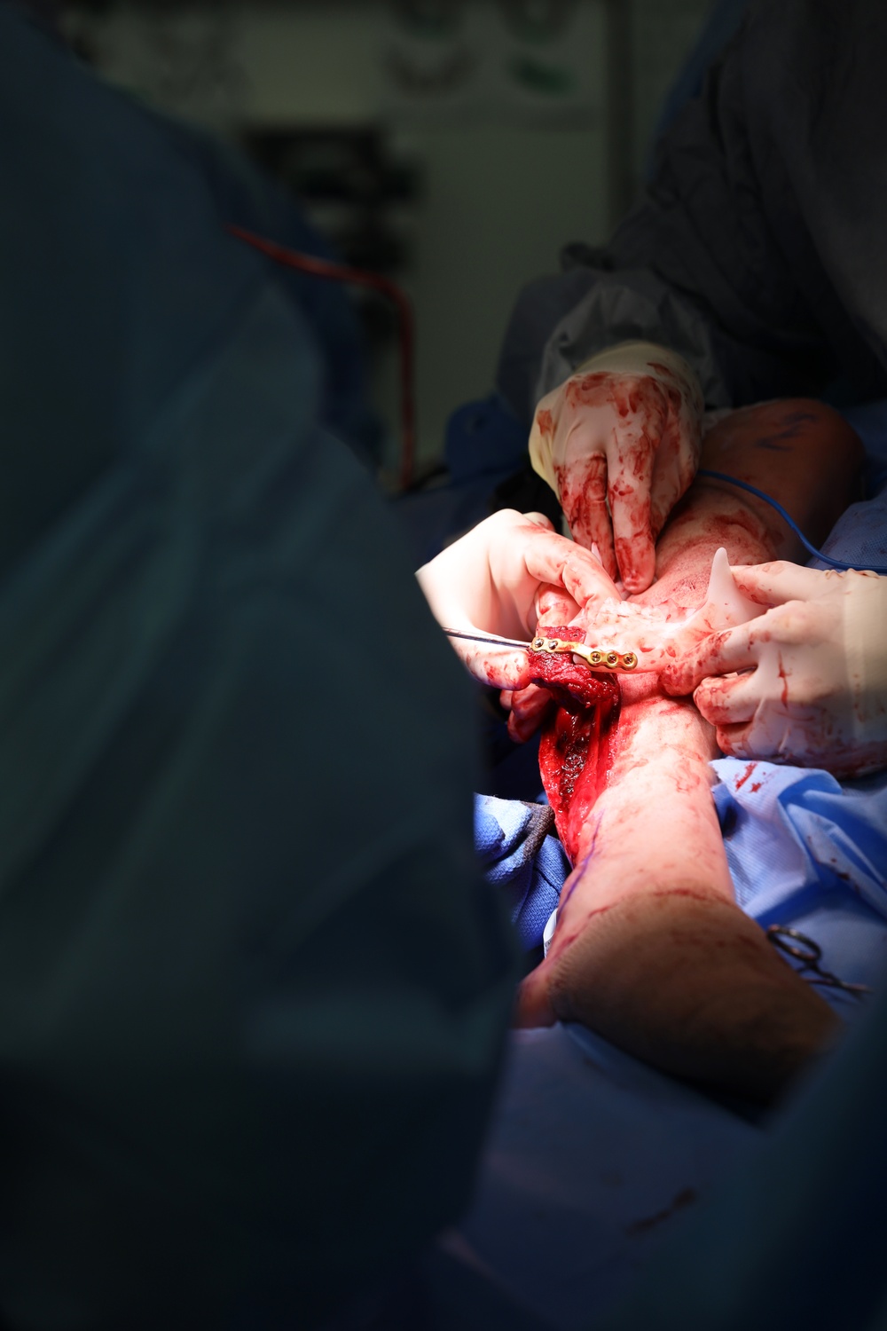 Maxillofacial Program at NMCSD Restores Form, Function, and Readiness