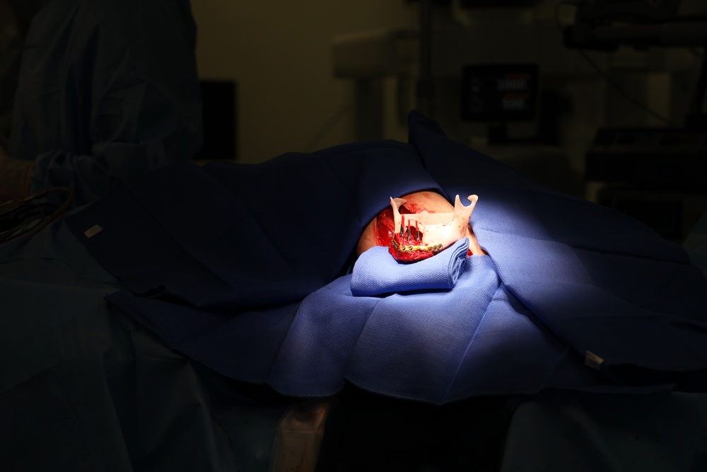 Maxillofacial Program at NMCSD Restores Form, Function, and Readiness