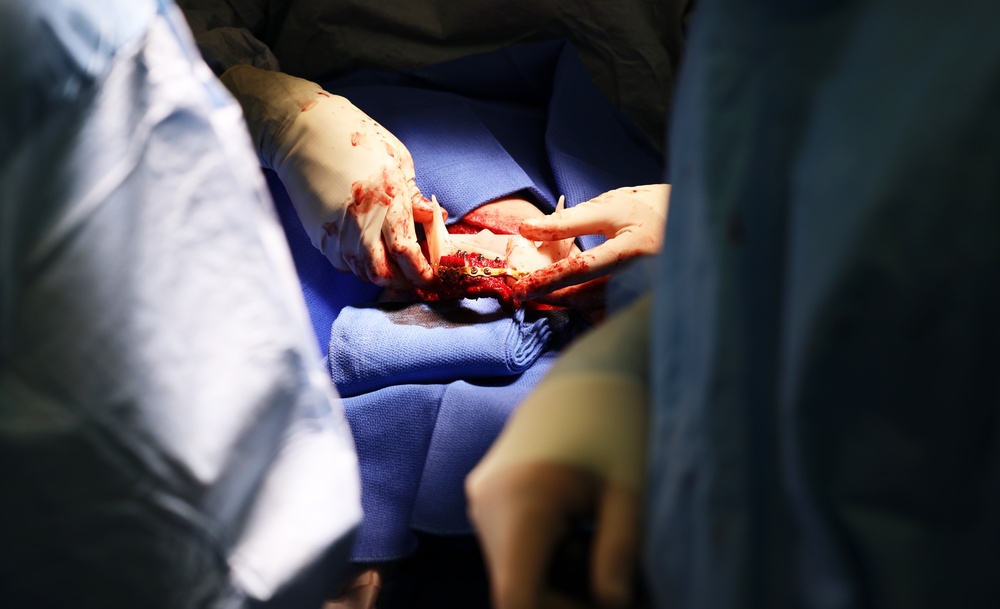 Maxillofacial Program at NMCSD Restores Form, Function, and Readiness