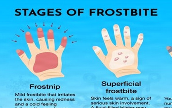 405th AFSB puts ‘the freeze’ on cold weather winter hazards with safety training, resources